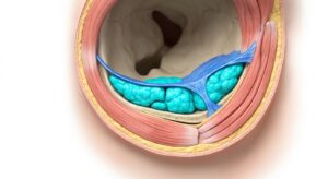 눈밑 안와지방과 격막의 해부학적 구조 3D 일러스트